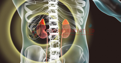 Ginjal Pria Ini Rusak Akibat Overdosis Vitamin D, Ini Gejala yang Dialaminya