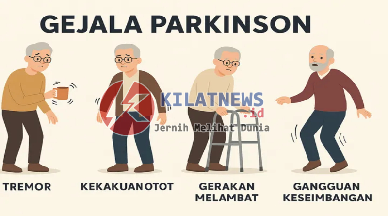 Ilustrasi dokter menjelaskan penyakit Parkinson dan faktor risikonya